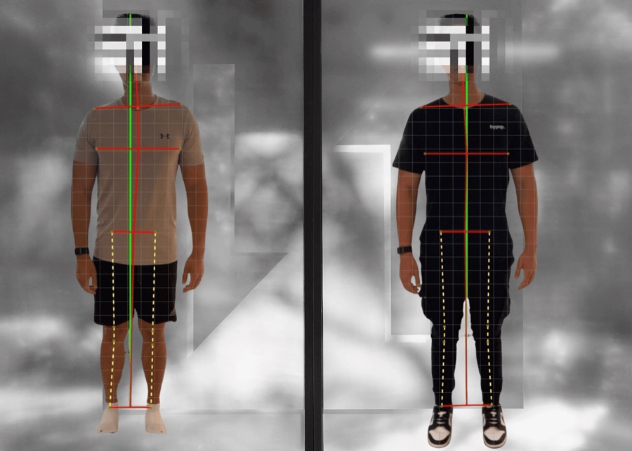 Posture scan before and after
