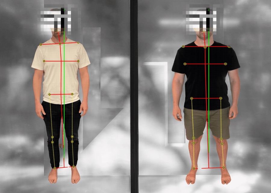 Posture scan before and after